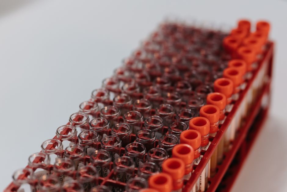 A detailed view of lab test tubes in a rack, perfect for research visuals.